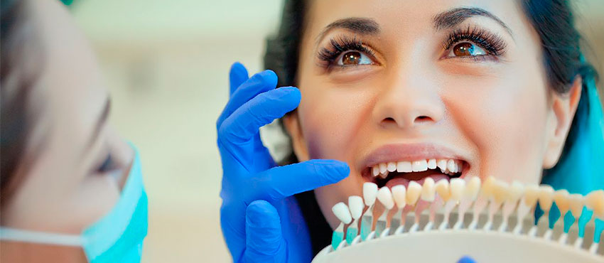 Какой цвет виниров выбрать - стоматологическая клиника «Медицентр»