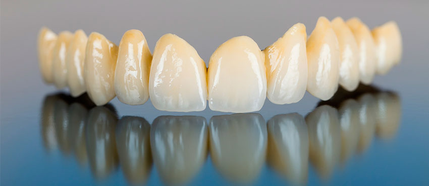 Что лучше композитные или керамические виниры - стоматологическая клиника «Медицентр»
